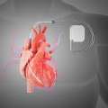 Expert Care At Pacemaker Clinic Abu Dhabi | Bone Care One Day Surgery Center