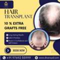 Top Rated No.1 Hair Transplant Clinic In Thane | DNA Royal.