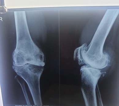 Kolkata, Health, What You Should Know About Bone Doctor In Behala, Kolkata?
