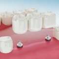 Tooth Or Dare: Dental Crown Procedure