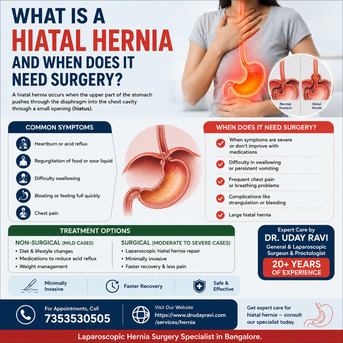 Bangalore, Health, What Is A Hiatal Hernia And When Does It Need Surgery?