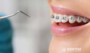 Toronto, Dental, Orthodontics In Etobicoke &ndash; Book Your Appointment Today
