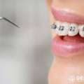 Orthodontics In Etobicoke &ndash; Book Your Appointment Today