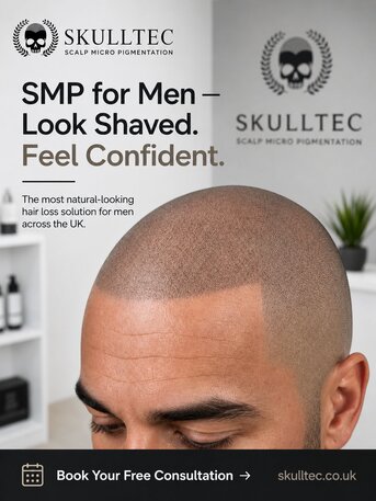 Edinburgh, Health, SMP For Men In London | Expert Hair Loss Solutions By Skulltec