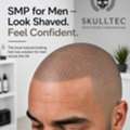 SMP For Men In London | Expert Hair Loss Solutions By Skulltec