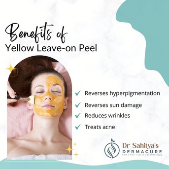 Kurnool, Health, Yellow Peel Treatment At Dermacure - Rajahmundry