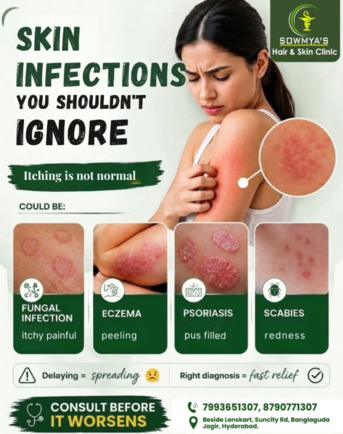 Hyderabad, Health, Healthy Skin Begins With Expert Care
