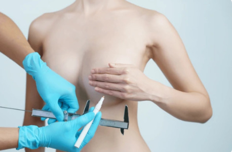 Cape Town, Health, Breast Reduction Cape Town | Breast Enlargement