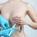 Breast Reduction Cape Town | Breast Enlargement