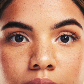 Los Angeles, Health, Brow Lift Treatment In Los Angeles