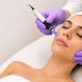 Microneedling Etobicoke