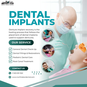 Washington DC, Health, Signs Your Dentures Implants Recovery Is Progressing Normally !