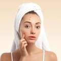 Summer Skincare Tips For Acne-Prone Skin &mdash; Suggest