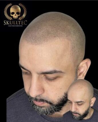 London, Beautician, Hair Tattoo & Hairline Tattoo For Men | Skulltec