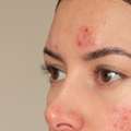 Lightweight Daily Glow Support For Breakout-Prone Skin