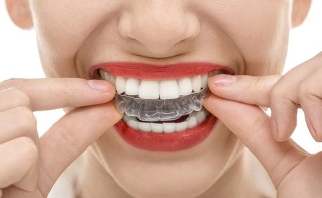 San Diego, Health, Teeth Straightening In San Diego