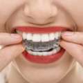 Teeth Straightening In San Diego