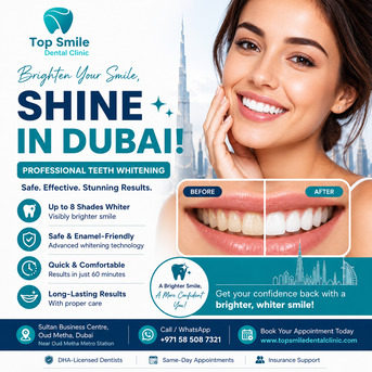 Dubai, Dental, Professional Teeth Whitening In Dubai | Top Smile Dental Clinic