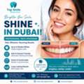 Professional Teeth Whitening In Dubai | Top Smile Dental Clinic