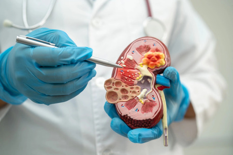Ahmedabad, Health, Trusted Urologist In Ahmedabad