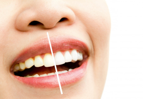 New York, Dental, Exceptional Dental Care For Every Smile