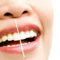 Exceptional Dental Care For Every Smile