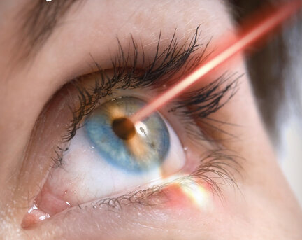 Faridabad, Health, Best Laser Eye Surgery In Faridabad | Say Goodbye To Glasses