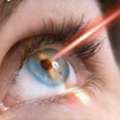 Best Laser Eye Surgery In Faridabad | Say Goodbye To Glasses