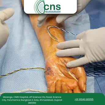 Ahmedabad, Health, Restore Nerve Function With Expert Peripheral Nerve Surgery In Ahmedabad