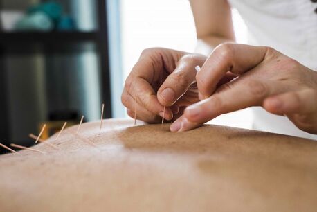 New York, Health, Experienced Acupuncturists In Tucson AZ For Natural Wellness