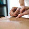 Experienced Acupuncturists In Tucson AZ For Natural Wellness