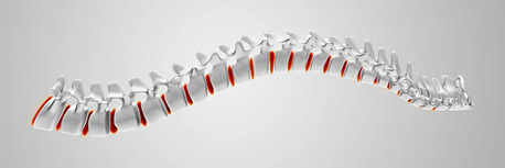Kabul, Health, 3D Spinal Decompression McKinney TX | Kurv O2 Advanced Chiropractic