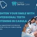 Brighten Your Smile With Professional Teeth Whitening In Casula