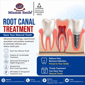Kolkata, Dental, Root Canal Treatment Cost In Kolkata - Affordable & Transparent Pricing