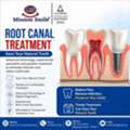 Root Canal Treatment Cost In Kolkata - Affordable & Transparent Pricing
