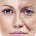Affordable Anti Ageing Facials In Surrey | Book Today