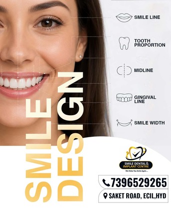 Hyderabad, Dental, Premium Digital Smile Designing &ndash; Smile Dental & Implant Centre, ECIL