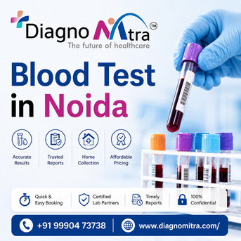 Noida, Health, Blood Test In Noida &ndash; Home Sample Collection & Health Checkup
