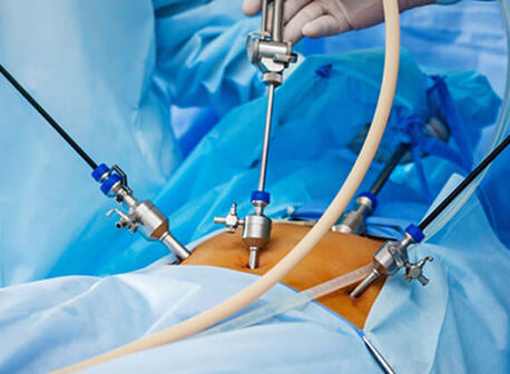 New Delhi, Health, Laparoscopy For Infertility In Delhi - Dr Rhythm Gupta