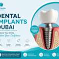 Dental Implants Dubai &ndash; Restore Your Smile With Confidence