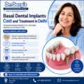 Basal Dental Implants Cost And Treatment In Delhi