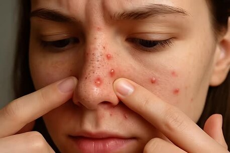 New York, Health, Deep Cleansing Face Wash For Breakout-Prone Skin
