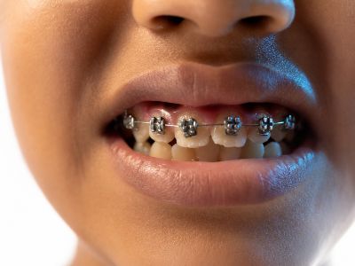 Kolkata, General, AB Dentologic: Advanced Dentistry For Healthy Smiles