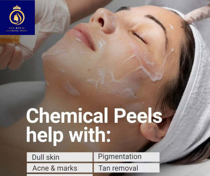Thane, Fashion & Design, Get Radiant Skin With Chemical Face Peel In Thane At DNA Royal.