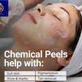 Get Radiant Skin With Chemical Face Peel In Thane At DNA Royal.