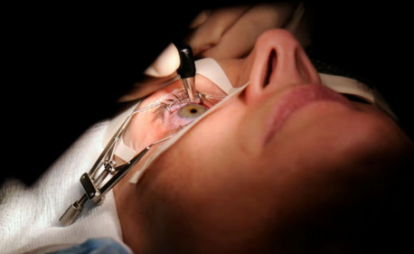 New York, Health, Laser Vision Correction In Orange County | LASIK & PRK &ndash; EyeOC