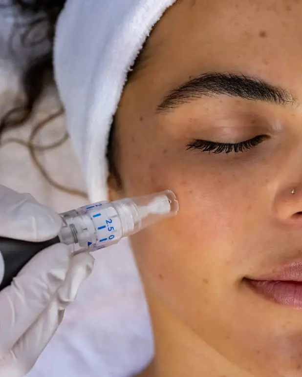 Houston, Health, Microneedling Treatment Near Me For Healthier Skin