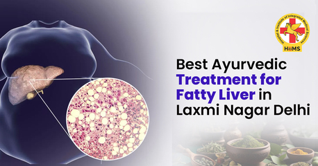 Laxmi Nagar, Health, Best Ayurvedic Treatment For Fatty Liver In Laxmi Nagar Delhi