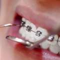Professional Dental Cleaning Near You &ndash; Call Now