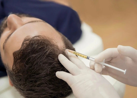 Bangalore, Health, Advanced Hair Fall & Loss PRP Treatment In Bannerghatta Road